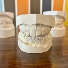 Load image into Gallery viewer, Vintage Dental Teeth Molds
